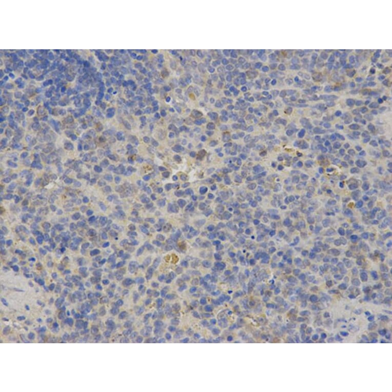 Immunohistochemistry - FGB Antibody from Signalway Antibody (32273) - Antibodies.com