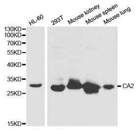 Western blot - CA2 Antibody from Signalway Antibody (32279) - Antibodies.com