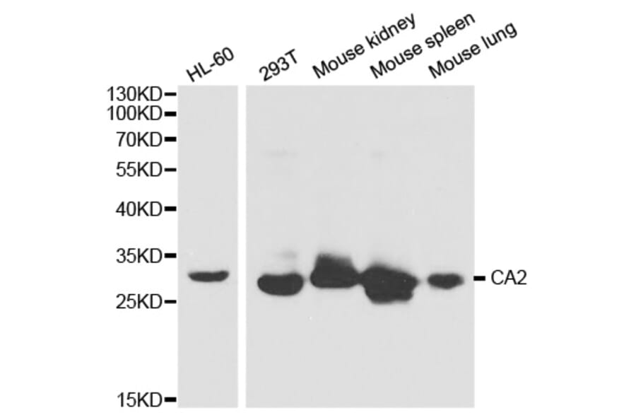 Western blot - CA2 Antibody from Signalway Antibody (32279) - Antibodies.com