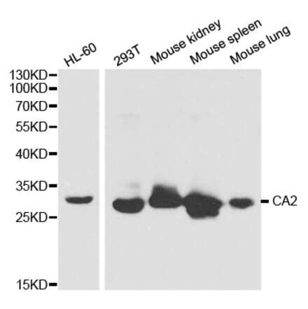 Western blot - CA2 Antibody from Signalway Antibody (32279) - Antibodies.com