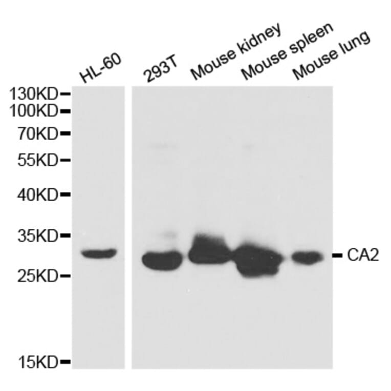 Western blot - CA2 Antibody from Signalway Antibody (32279) - Antibodies.com
