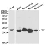 Western blot - CA2 Antibody from Signalway Antibody (32279) - Antibodies.com