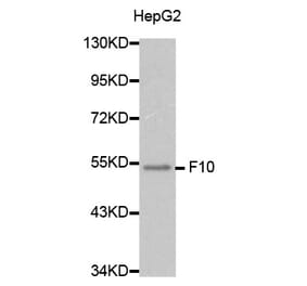 Western blot - F10 Antibody from Signalway Antibody (32282) - Antibodies.com