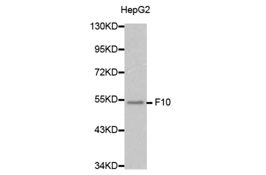 Western blot - F10 Antibody from Signalway Antibody (32282) - Antibodies.com