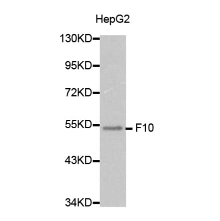 Western blot - F10 Antibody from Signalway Antibody (32282) - Antibodies.com