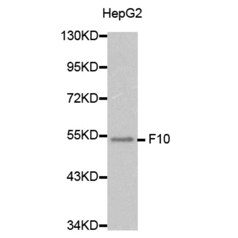 Western blot - F10 Antibody from Signalway Antibody (32282) - Antibodies.com