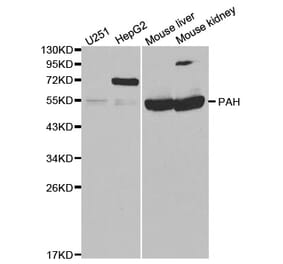 Western blot - PAH Antibody from Signalway Antibody (32308) - Antibodies.com