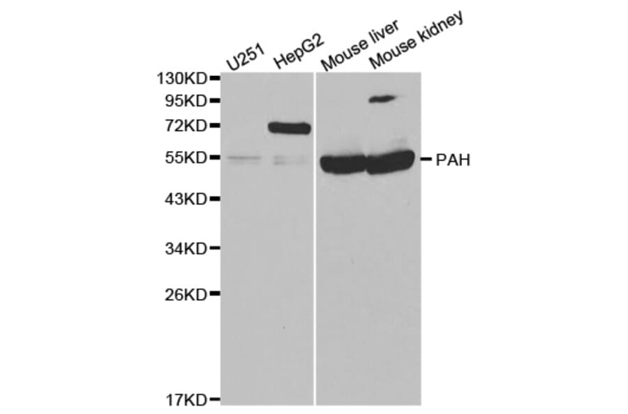 Western blot - PAH Antibody from Signalway Antibody (32308) - Antibodies.com