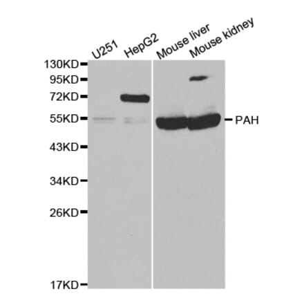 Western blot - PAH Antibody from Signalway Antibody (32308) - Antibodies.com