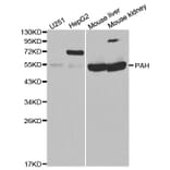 Western blot - PAH Antibody from Signalway Antibody (32308) - Antibodies.com
