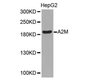 Western blot - A2M Antibody from Signalway Antibody (32318) - Antibodies.com