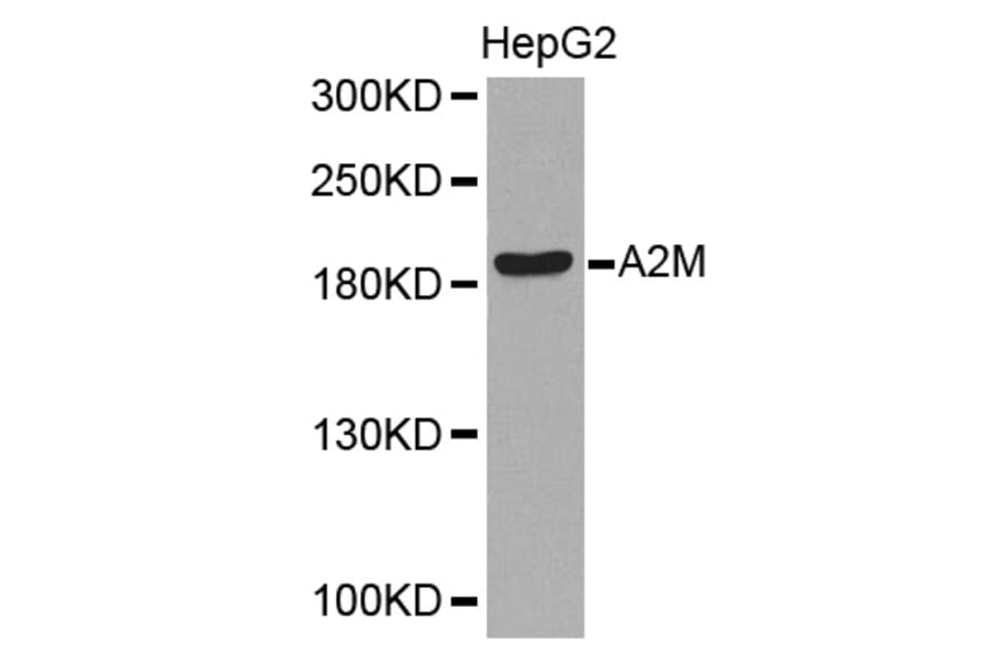 Western blot - A2M Antibody from Signalway Antibody (32318) - Antibodies.com