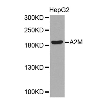 Western blot - A2M Antibody from Signalway Antibody (32318) - Antibodies.com