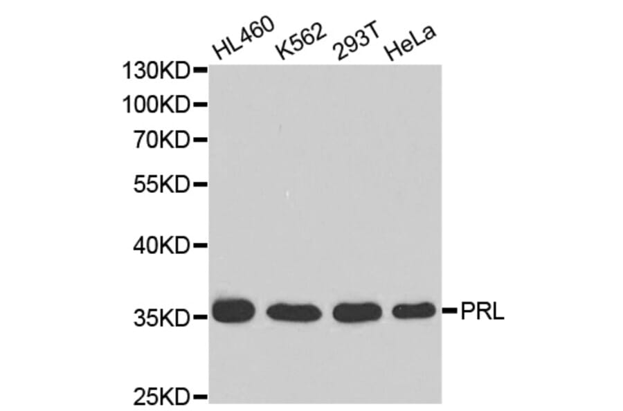 Western blot - PRL Antibody from Signalway Antibody (32345) - Antibodies.com