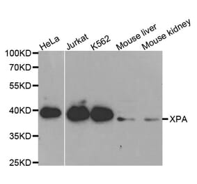 Western blot - XPA Antibody from Signalway Antibody (32352) - Antibodies.com