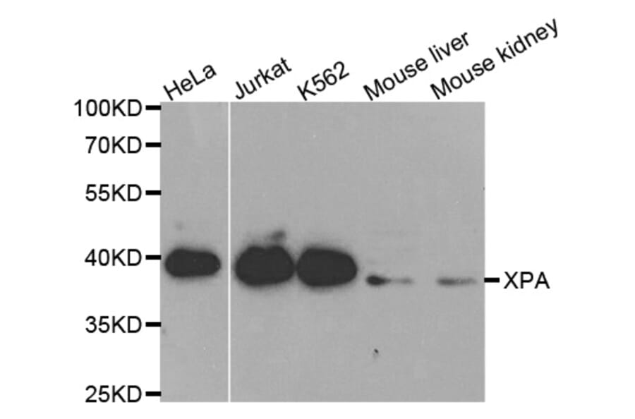 Western blot - XPA Antibody from Signalway Antibody (32352) - Antibodies.com