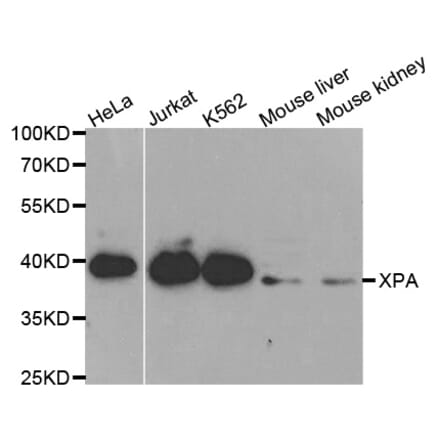 Western blot - XPA Antibody from Signalway Antibody (32352) - Antibodies.com