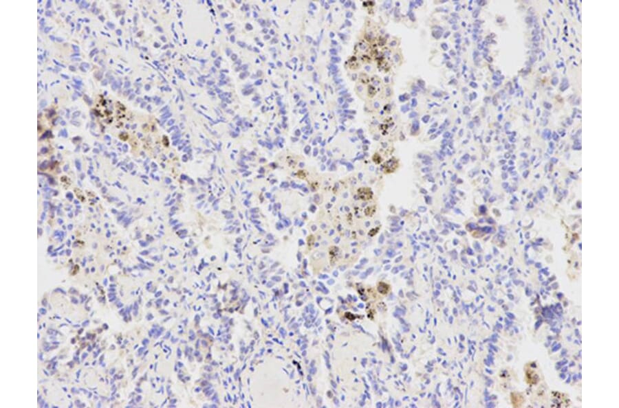 Immunohistochemistry - XPA Antibody from Signalway Antibody (32352) - Antibodies.com