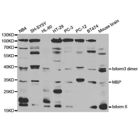 Western blot - MBP Antibody from Signalway Antibody (32374) - Antibodies.com