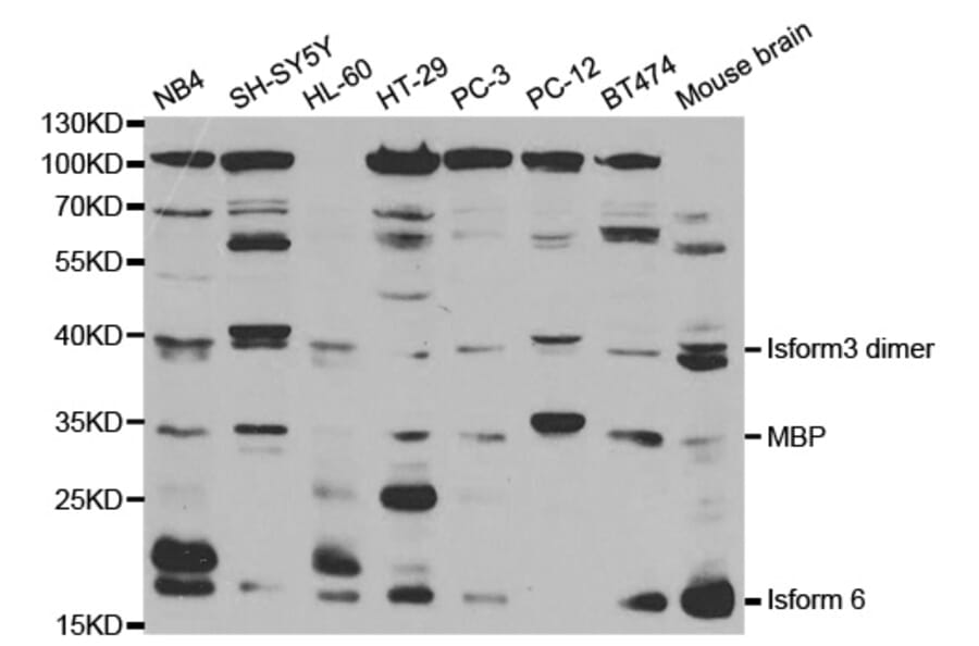 Western blot - MBP Antibody from Signalway Antibody (32374) - Antibodies.com