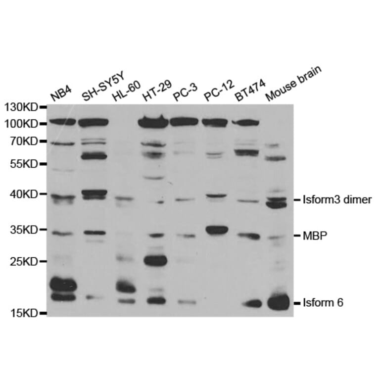 Western blot - MBP Antibody from Signalway Antibody (32374) - Antibodies.com