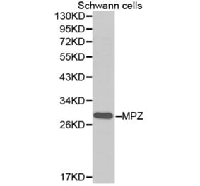 Western blot - MPZ Antibody from Signalway Antibody (32386) - Antibodies.com
