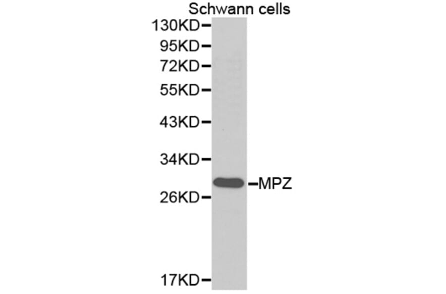 Western blot - MPZ Antibody from Signalway Antibody (32386) - Antibodies.com