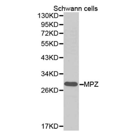 Western blot - MPZ Antibody from Signalway Antibody (32386) - Antibodies.com