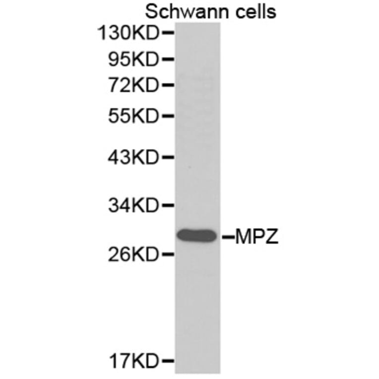 Western blot - MPZ Antibody from Signalway Antibody (32386) - Antibodies.com