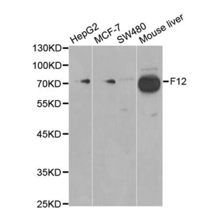 Western blot - F12 Antibody from Signalway Antibody (32389) - Antibodies.com