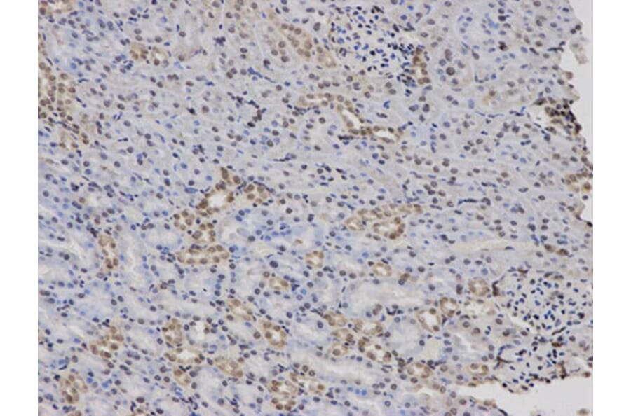 Immunohistochemistry - F12 Antibody from Signalway Antibody (32389) - Antibodies.com