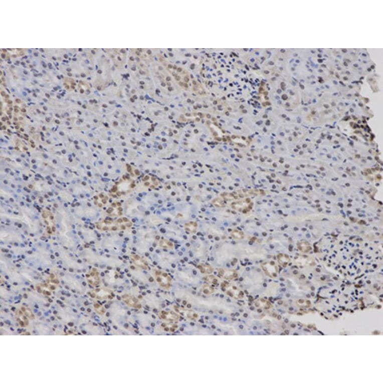 Immunohistochemistry - F12 Antibody from Signalway Antibody (32389) - Antibodies.com