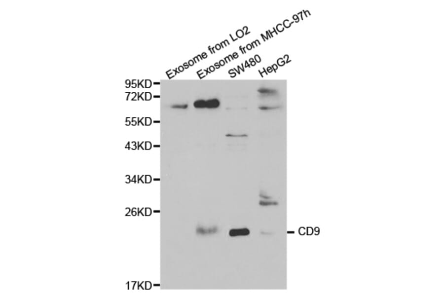 Western blot - CD9 Antibody from Signalway Antibody (32395) - Antibodies.com