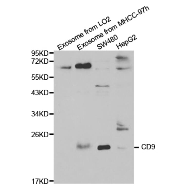 Western blot - CD9 Antibody from Signalway Antibody (32395) - Antibodies.com