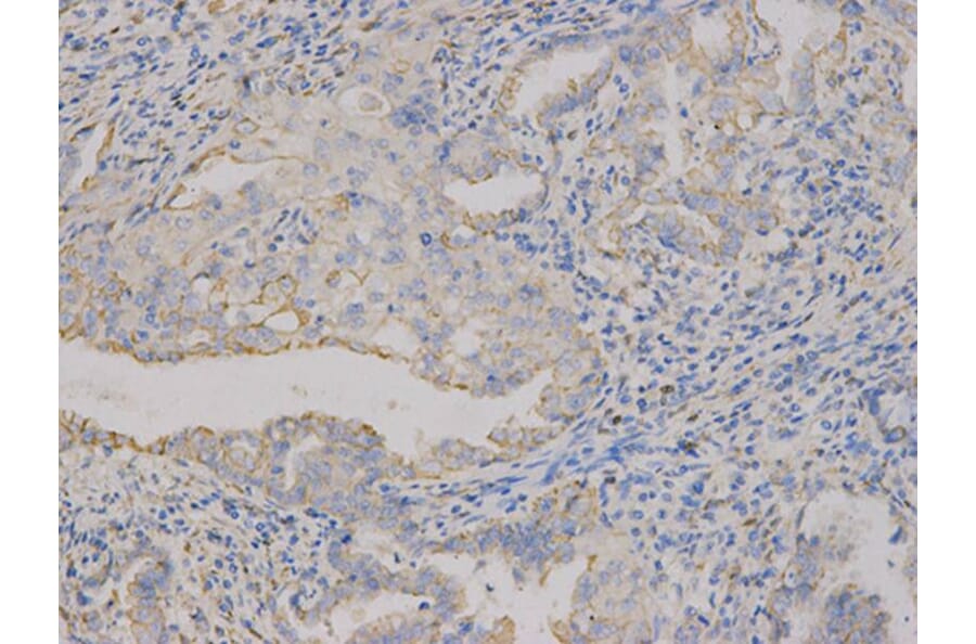 Immunohistochemistry - CD9 Antibody from Signalway Antibody (32395) - Antibodies.com