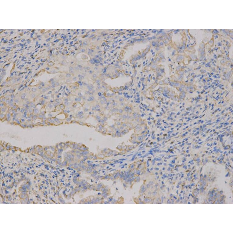 Immunohistochemistry - CD9 Antibody from Signalway Antibody (32395) - Antibodies.com