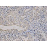 Immunohistochemistry - CD9 Antibody from Signalway Antibody (32395) - Antibodies.com