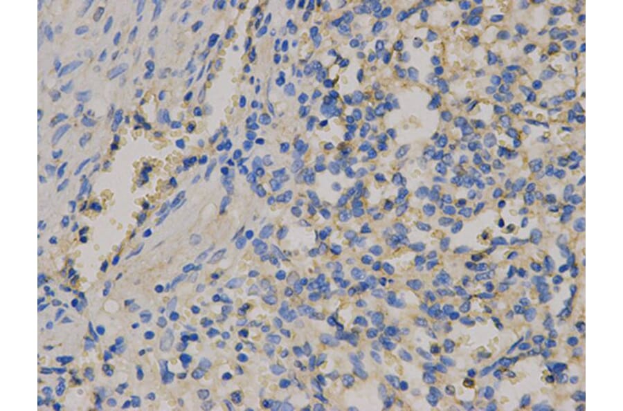 Immunohistochemistry - CD9 Antibody from Signalway Antibody (32395) - Antibodies.com