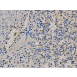 Immunohistochemistry - CD9 Antibody from Signalway Antibody (32395) - Antibodies.com