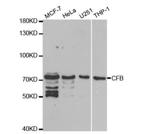 Western blot - CFB Antibody from Signalway Antibody (32396) - Antibodies.com