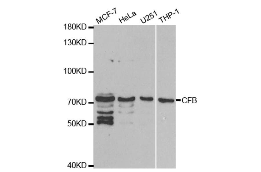 Western blot - CFB Antibody from Signalway Antibody (32396) - Antibodies.com