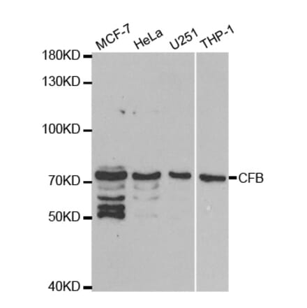 Western blot - CFB Antibody from Signalway Antibody (32396) - Antibodies.com