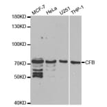 Western blot - CFB Antibody from Signalway Antibody (32396) - Antibodies.com