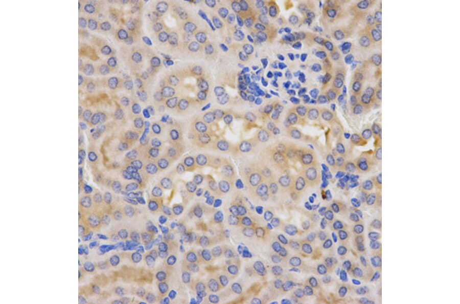 Immunohistochemistry - CFB Antibody from Signalway Antibody (32396) - Antibodies.com