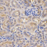 Immunohistochemistry - CFB Antibody from Signalway Antibody (32396) - Antibodies.com