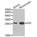 Western blot - PGF Antibody from Signalway Antibody (32404) - Antibodies.com