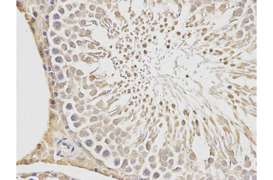 Immunohistochemistry - PGF Antibody from Signalway Antibody (32404) - Antibodies.com