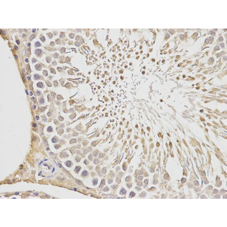 Immunohistochemistry - PGF Antibody from Signalway Antibody (32404) - Antibodies.com