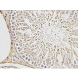 Immunohistochemistry - PGF Antibody from Signalway Antibody (32404) - Antibodies.com