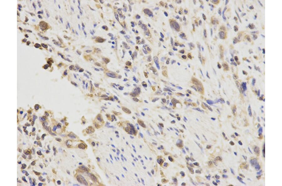 Immunohistochemistry - PGF Antibody from Signalway Antibody (32404) - Antibodies.com